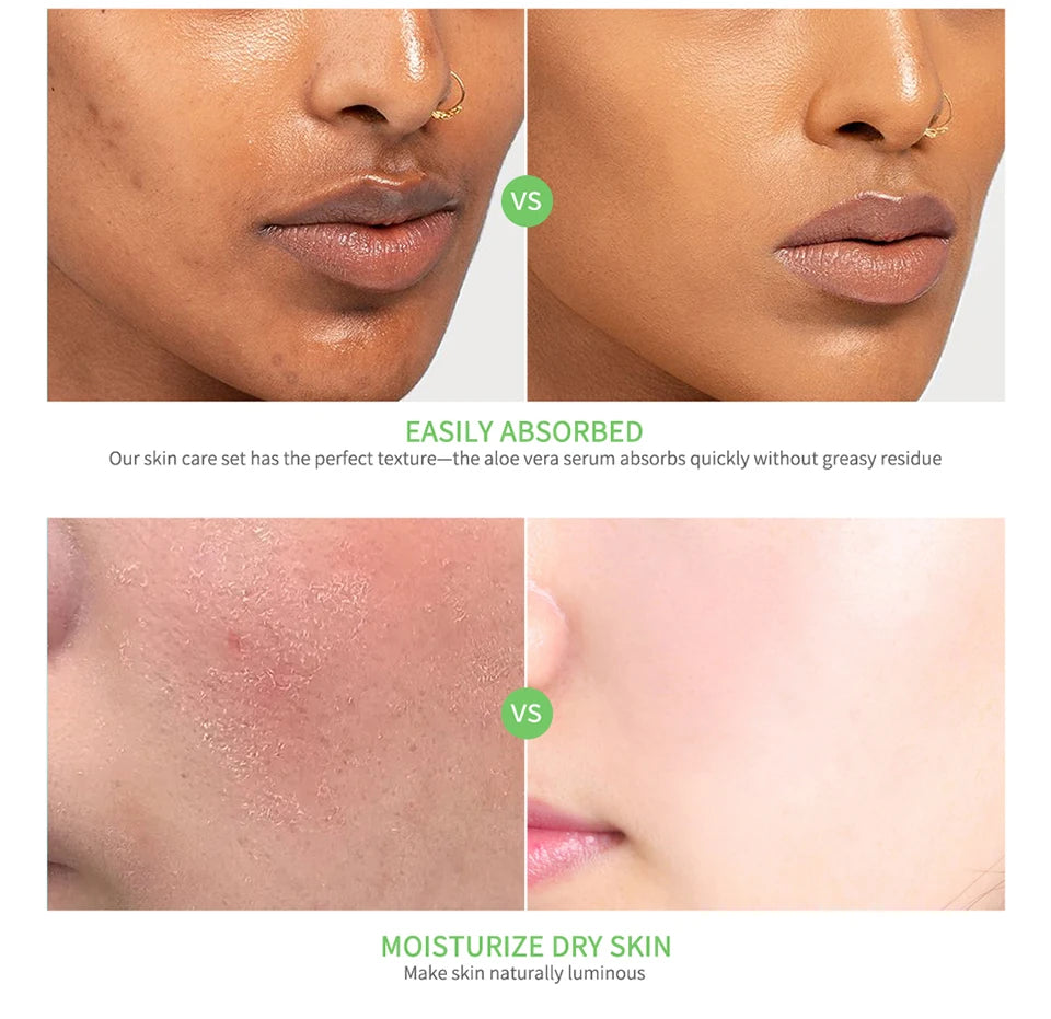 Set per la cura della pelle Idratante profondo Nutrimento profondo Sbiancamento Illuminante Idratante Pelle liscia