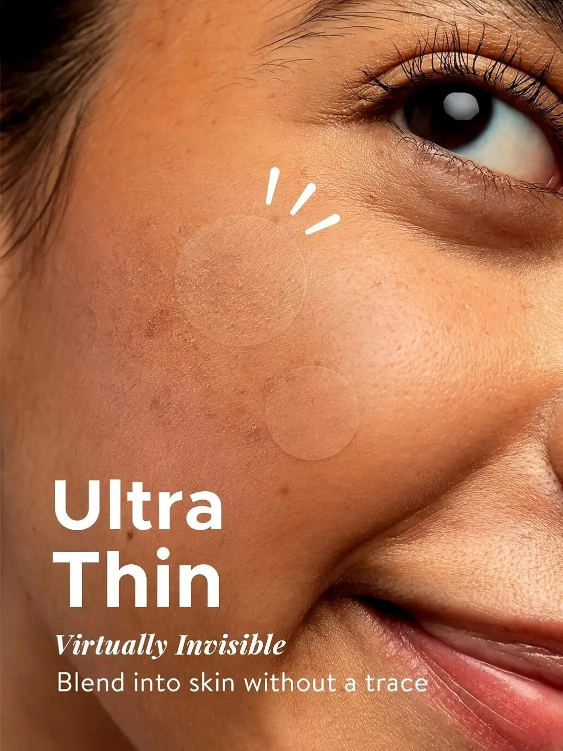 360pcs Patch per l’acne Guarigione antinfiammatoria
