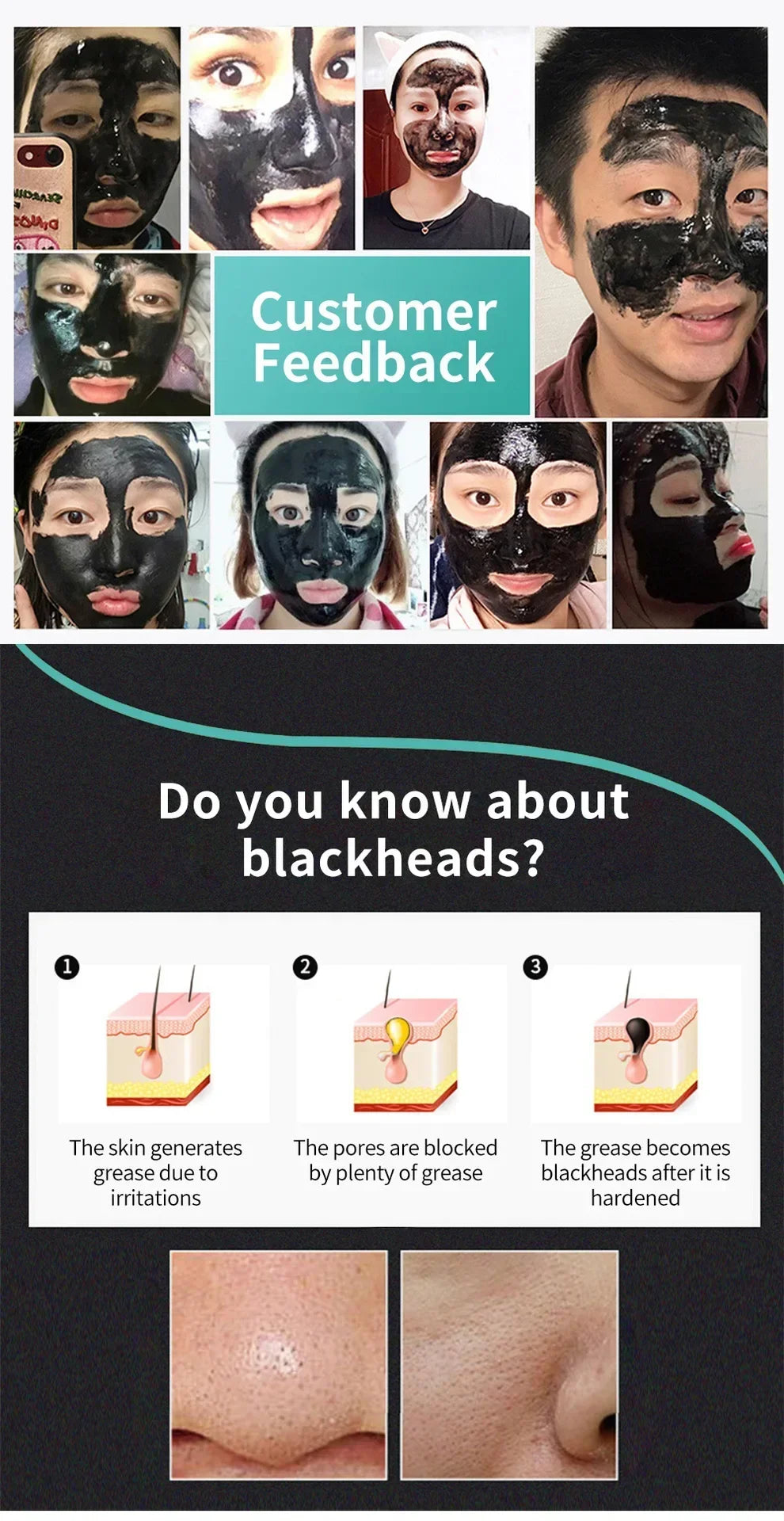 Maschera per i punti neri LANBENA