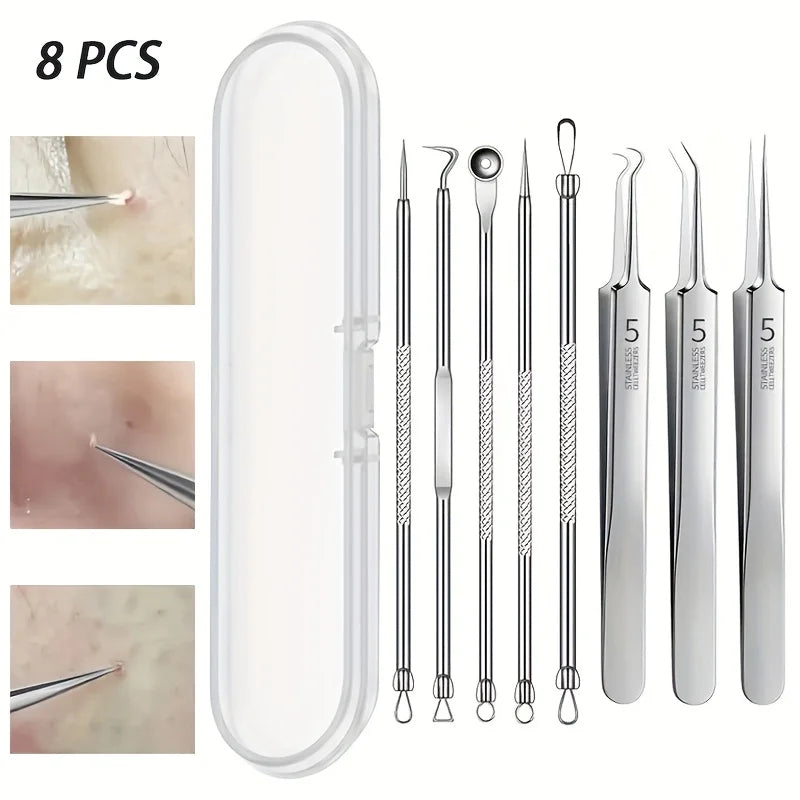 Kit di rimozione di punti neri da 8 pezzi - Strumenti per l’estrazione di imperfezioni e acne in acciaio inossidabile - Set professionale di popper per brufoli per tutta la pelle