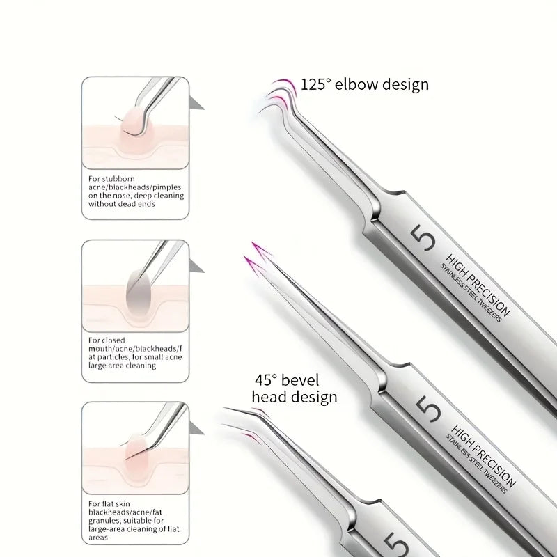 Kit di rimozione di punti neri da 8 pezzi - Strumenti per l’estrazione di imperfezioni e acne in acciaio inossidabile - Set professionale di popper per brufoli per tutta la pelle